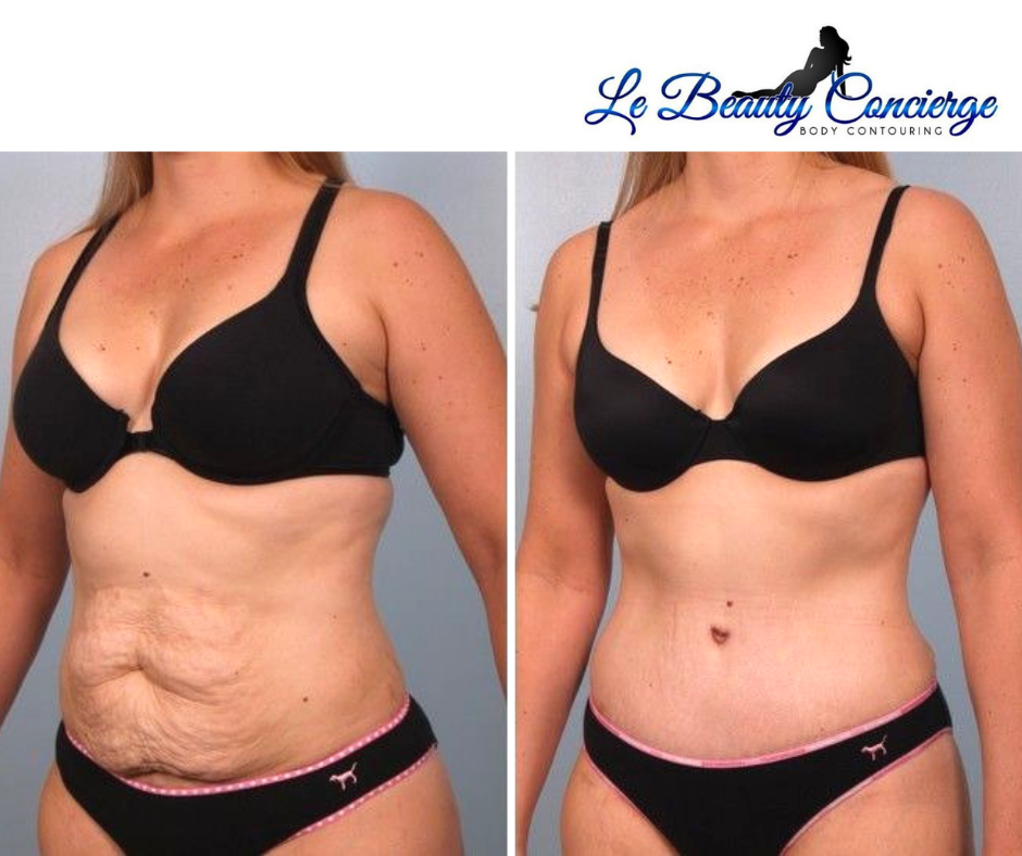 THE BEST 10 Body Contouring near NORTH HOUSTON, TX - Last Updated